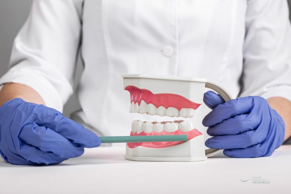 rimuovere i denti del giudizio